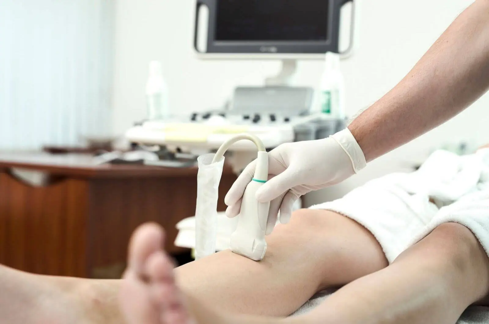 Color Doppler pregled vena noge u Poliklinici Puls Sarajevo